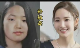 全智贤整容前后照片,揭秘整容前后惊人对比