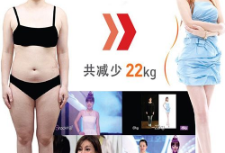 吸脂的明星,揭秘吸脂术在娱乐圈的流行趋势